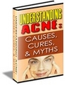 Thumbnail Understanding Acne - Causes, Cures & Myths