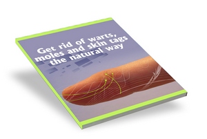 Product picture Get Rid Of Warts, Moles And Skin Tags The Natural Way
